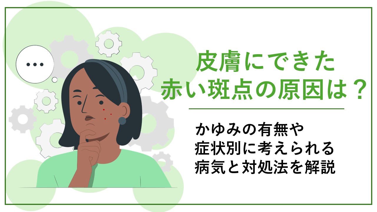 皮膚にできた赤い斑点の原因は?かゆみの有無や症状別に考えられる病気と対処法を解説