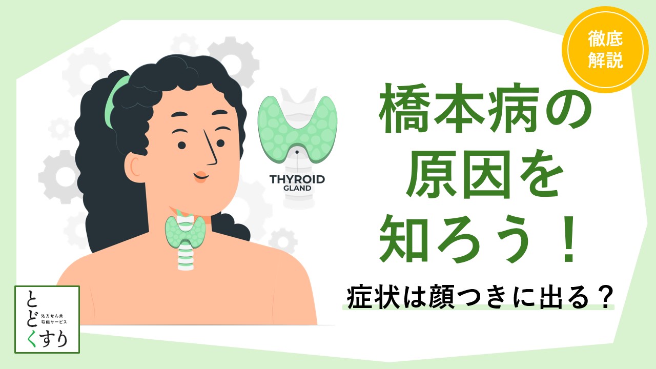 橋本病の原因を知ろう!症状は顔つきに出る?