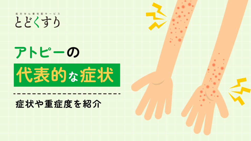 アトピー性皮膚炎の症状とは