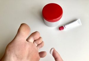 いんきんたむし(股部白癬)とぜにたむし(体部白癬)の原因は?似た症状についても解説 | とどくすり通信 | とどくすり - 処方箋薬、宅配 ...