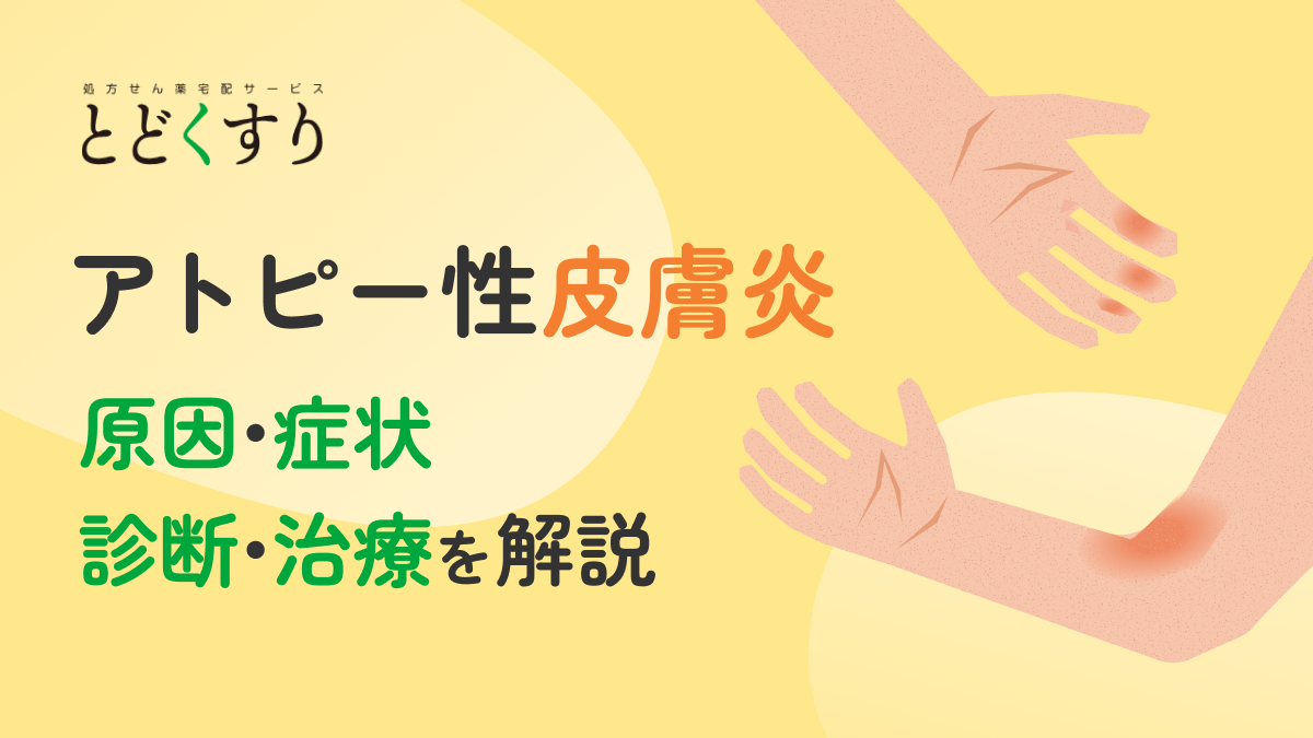 アトピー性皮膚炎とは？原因や治療方法について解説｜【とどくすり薬剤師がよくある質問に回答】