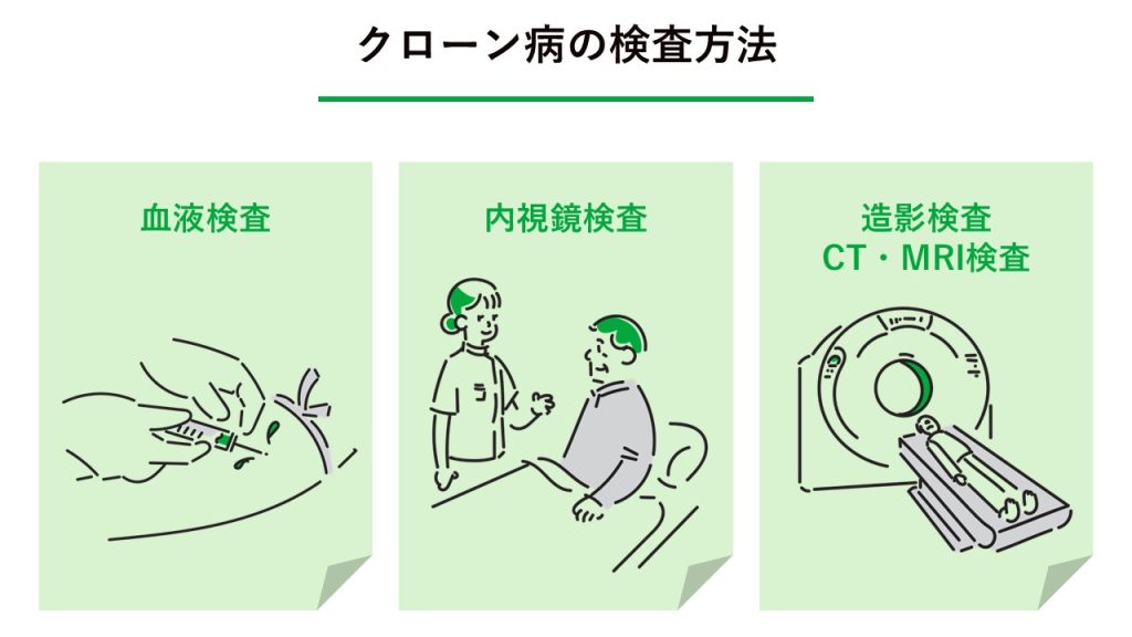 クローン病の検査方法