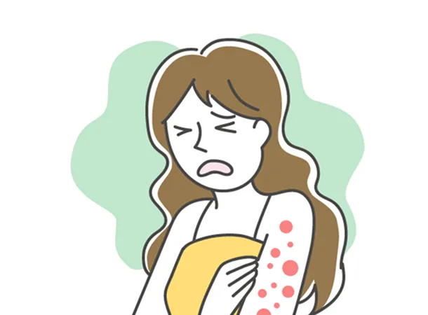 突発性の慢性蕁麻疹